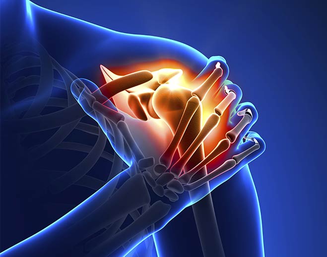 Illustration of shoulder joint pain